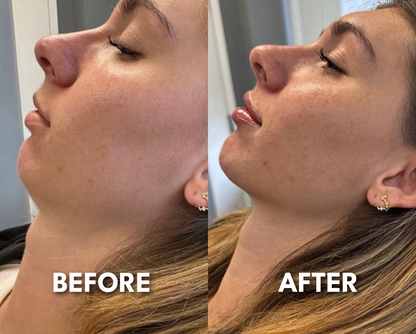 Lunava Facial Lifter